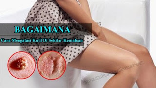 Kutil dekat kelamin, obat kutil kelamin, obat sakit kutil kelamin atau kutil di kemaluan apa, obat kutil kelamin yg ada di apotik, obat tradisional kutil pada kemaluan, kutil tumbuh di selangkangan, obat kutil kelamin atau kutil di kemaluan herbal jogja, kutil di kemaluan + h, obat kutil kelamin yang bagus apa, obat tradisional mengobati kutil kelamin atau kutil di kemaluan, obat kutil kelamin atau kutil di kemaluan untuk ibu menyusui